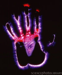 Фотография биополя руки по методу Кирлиана