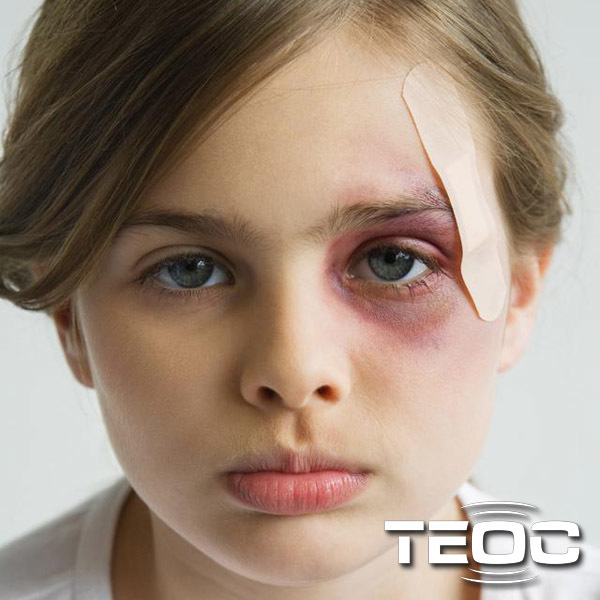 Отдых с увечиями (26.06.2015)